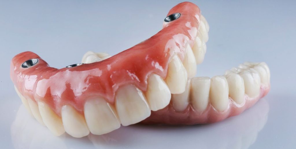 Cabecera Prótesis Dental