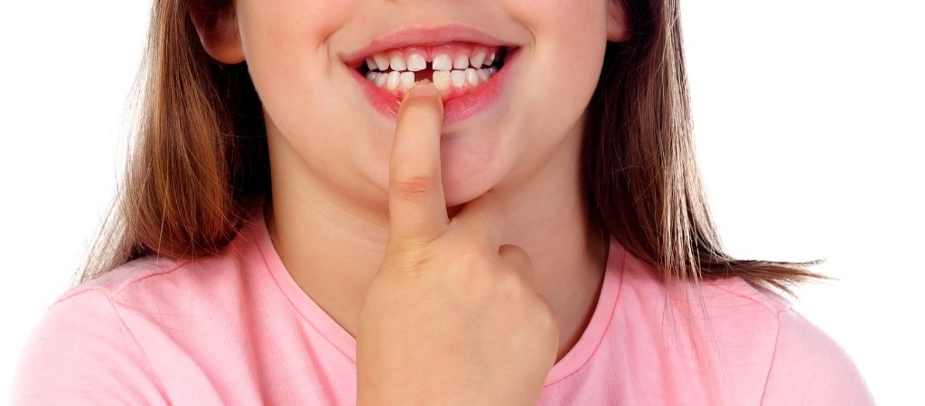 Niña con el diente roto